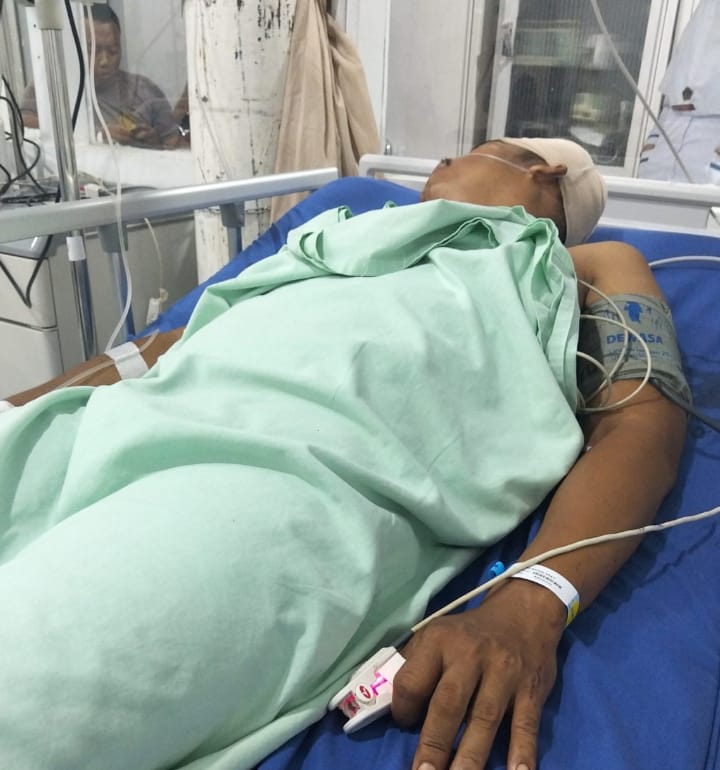 Sebulan Lebih Jalani Perawatan, Korban Pembacokan Akhirnya Meninggal Dunia