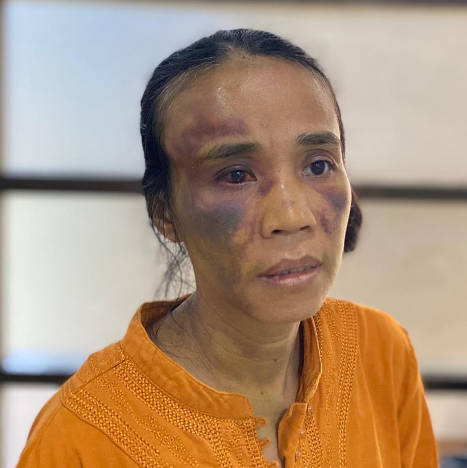 Keluarga Korban Laka Lantas Hiace Dan Fuso Di Bireuen Minta Pertanggungjawaban Vendor