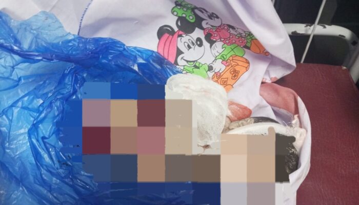 Korban Malpraktik Mendadak Ikhlaskan Kematian Bayinya Di RS B
