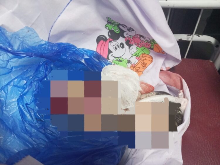 Korban Malpraktik Mendadak Ikhlaskan Kematian Bayinya Di RS B
