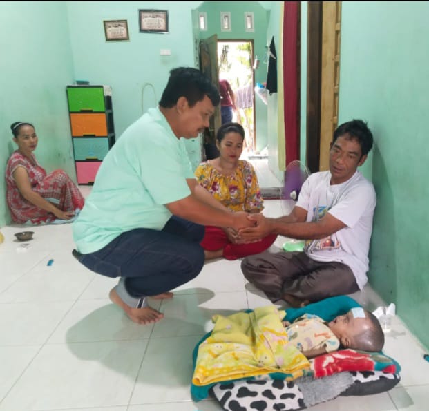 Pengusaha Muda Fasilitasi Bayi Menderita Hidrosefalus Dioperasi