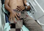 Jukir Luka-luka Dianiaya, Dishub Langkat Diminta Tertibkan Parkir Liar 