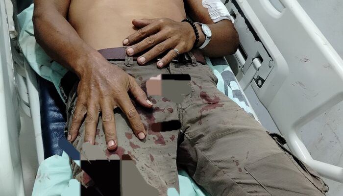 Jukir Luka-luka Dianiaya, Dishub Langkat Diminta Tertibkan Parkir Liar