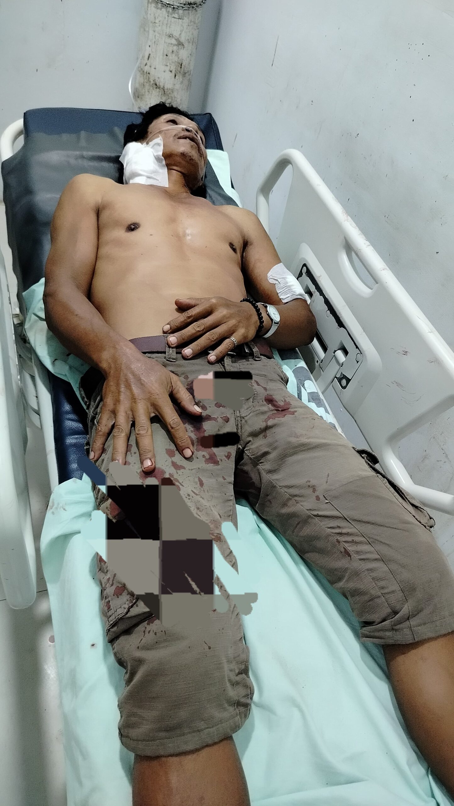 Jukir Luka-luka Dianiaya, Dishub Langkat Diminta Tertibkan Parkir Liar 