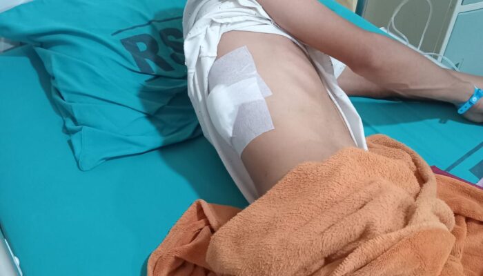 Monyet Liar Kembali Mangsa Warga Brandan 