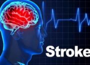 RS Adam Malik Tegaskan Komitmen Layani Stroke