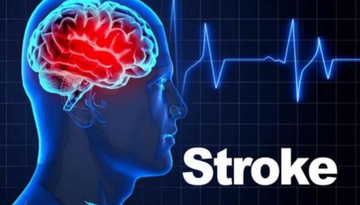RS Adam Malik Tegaskan Komitmen Layani Stroke