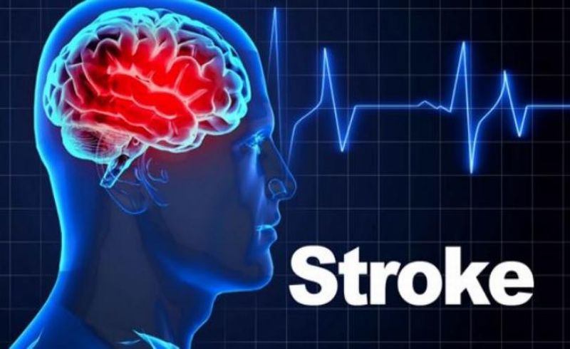 RS Adam Malik Tegaskan Komitmen Layani Stroke