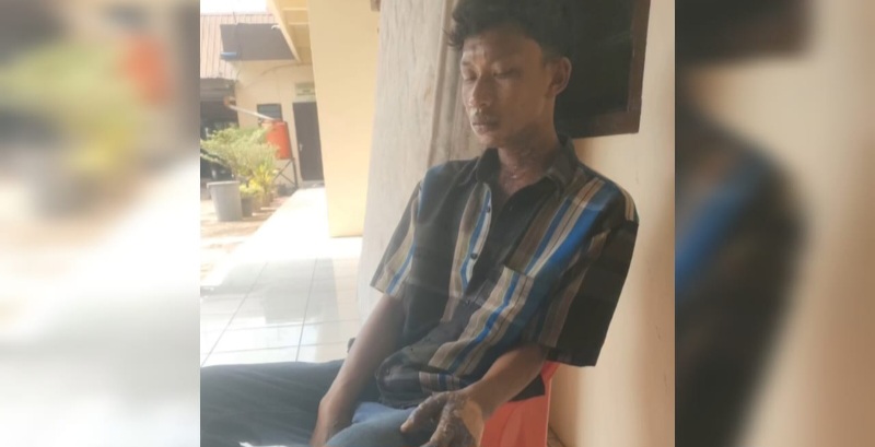 Mencuri Ubi, Seorang Remaja Dibakar Oknum ASN Pemkab Deliserdang