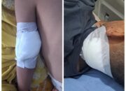 Monyet Liar Kembali Menambah Mangsa Warga Brandan 