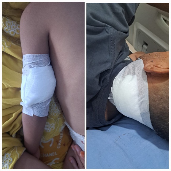 Monyet Liar Kembali Menambah Mangsa Warga Brandan 