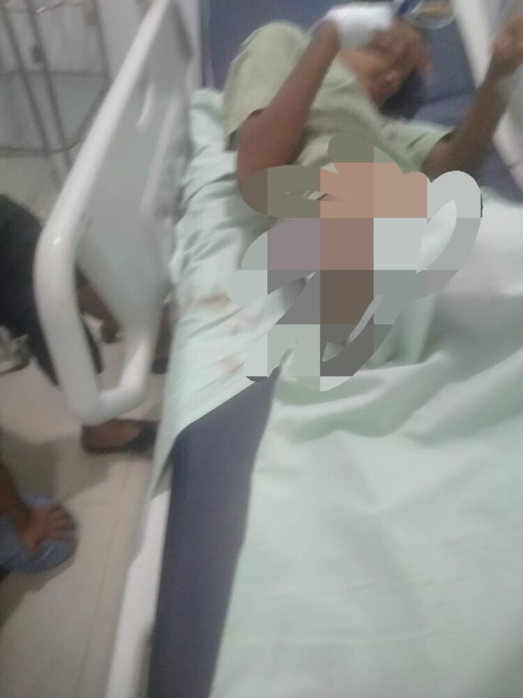 Lagi, Monyet Liar Serang Remaja 11 Tahun
