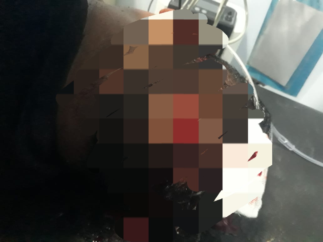 Honorer Imigrasi Kualanamu Jadi Korban Begal, Motor N-Max Raib