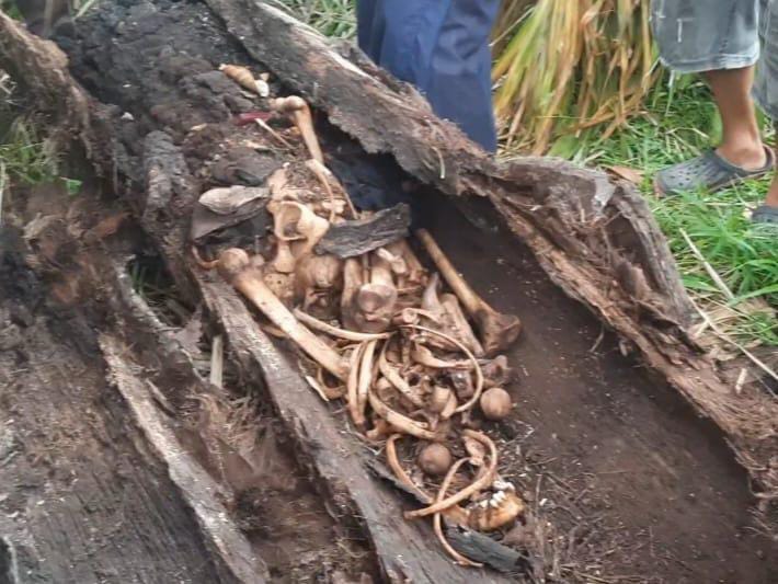 Kerangka Manusia Di Pohon Aren, Kasat Reskrim Sergai: Masih Penyelidikan, Jangan Percaya Isu Medsos