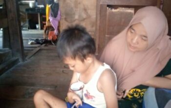 Rahmad Tak Punya Anus, Butuh Uluran Tangan Dermawan Dan Pemkab Mandailing Natal