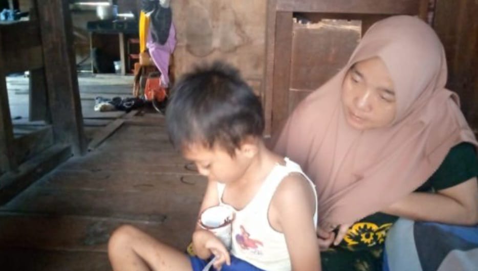 Rahmad Tak Punya Anus, Butuh Uluran Tangan Dermawan Dan Pemkab Mandailing Natal