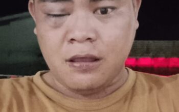 Dua Oknum P3K Diduga Terlibat Pengeroyokan Warga Di Nias Utara