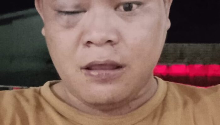 Dua Oknum P3K Diduga Terlibat Pengeroyokan Warga Di Nias Utara