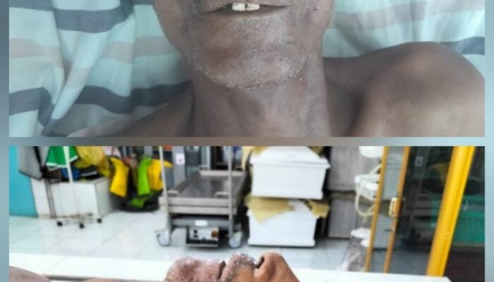 Polres Simalungun Cari Keluarga “Mr. X”, Korban Laka Lantas ODGJ