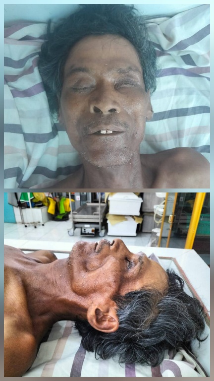 Polres Simalungun Cari Keluarga “Mr. X”, Korban Laka Lantas ODGJ