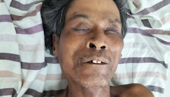 Mr. X Korban Laka Lantas Di Simalungun Meninggal, Identitas Belum Terungkap