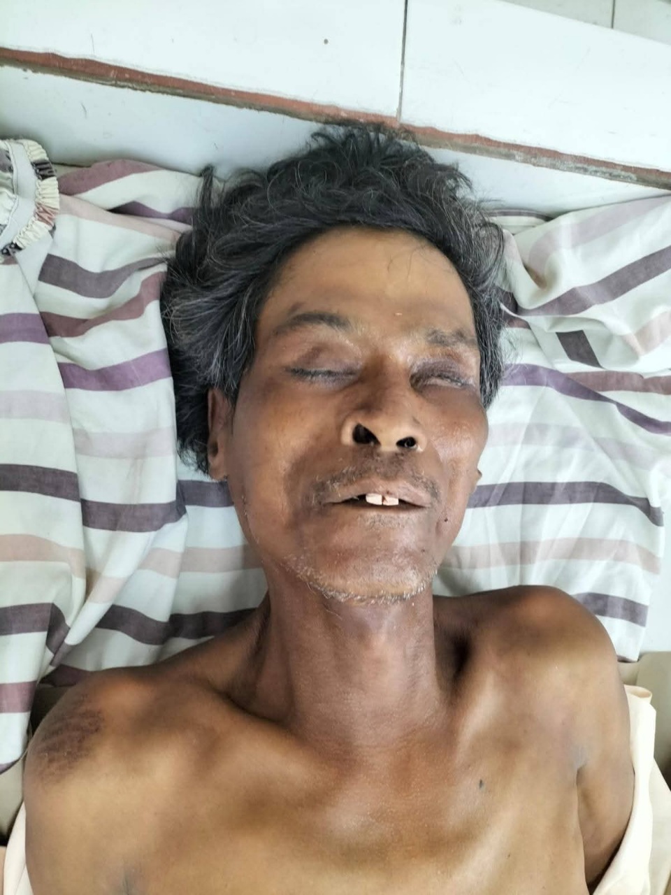 Mr. X Korban Laka Lantas Di Simalungun Meninggal, Identitas Belum Terungkap