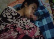 Empat Tahun Menahan Derita Tumor Mulut, Erni Hayati Butuh Uluran Tangan untuk Berobat