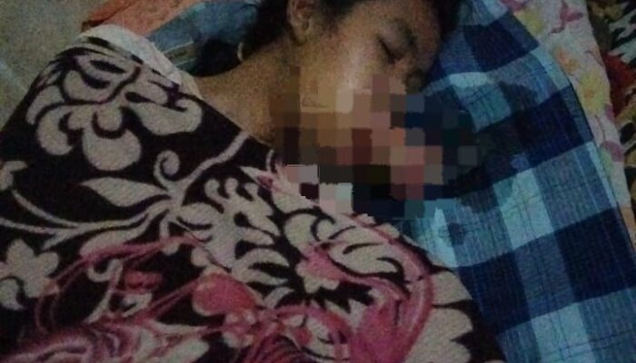 Empat Tahun Menahan Derita Tumor Mulut, Erni Hayati Butuh Uluran Tangan untuk Berobat