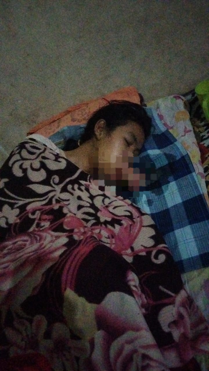 Empat Tahun Menahan Derita Tumor Mulut, Erni Hayati Butuh Uluran Tangan untuk Berobat