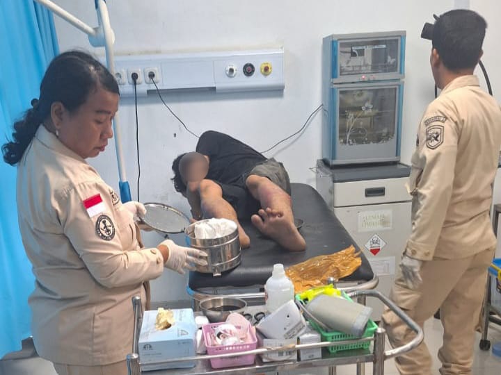 Polres Pelabuhan Belawan Tembak Pelaku Curas Usai Tawuran