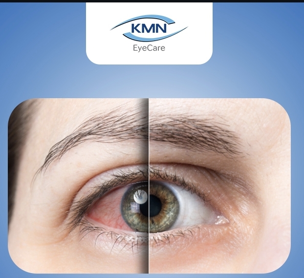 Mengenal SiLK, Teknologi LASIK Tanpa Flap yang Lebih Nyaman dan Minim Risiko