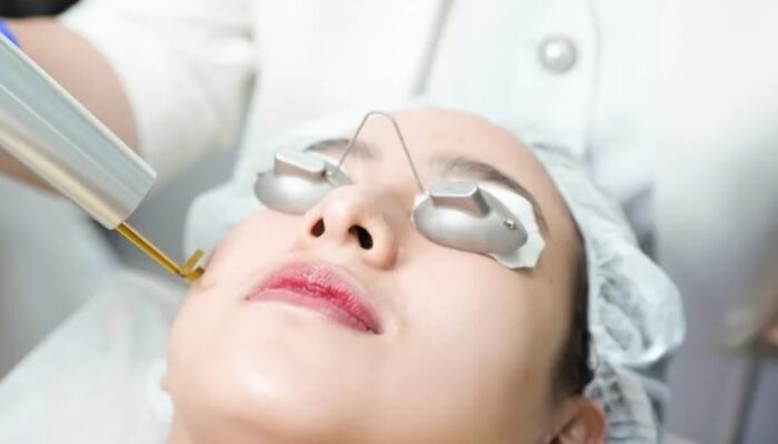 Pendekatan Menyeluruh Miracle Aesthetic Clinic, Tangani Keluhan Hiperpigmentasi Kulit Pelanggan Indonesia