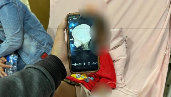 RSUD Pirngadi Tetap Tangani Korban Peluru Nyasar Tawuran Di Belawan Meski Tak Miliki BPJS Kesehatan