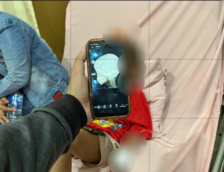 RSUD Pirngadi Tetap Tangani Korban Peluru Nyasar Tawuran Di Belawan Meski Tak Miliki BPJS Kesehatan