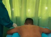 Puskesmas Langsa Barat Buka Layanan Klinik Therapy Akupuntur