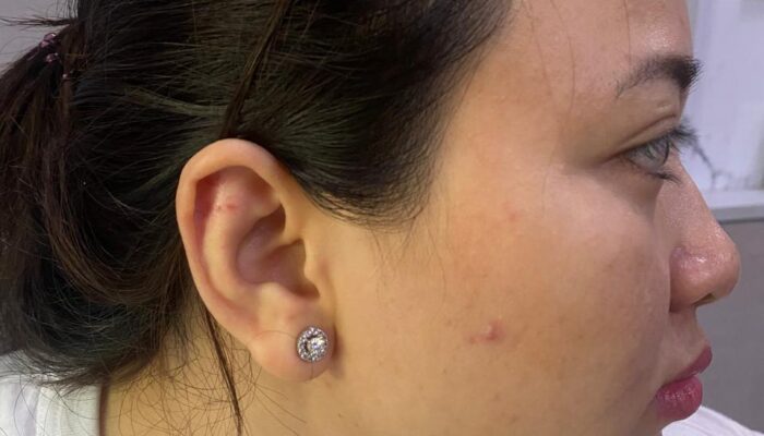 Dokter Kecantikan Laporkan Abang Kandung Kasus Penganiayaan