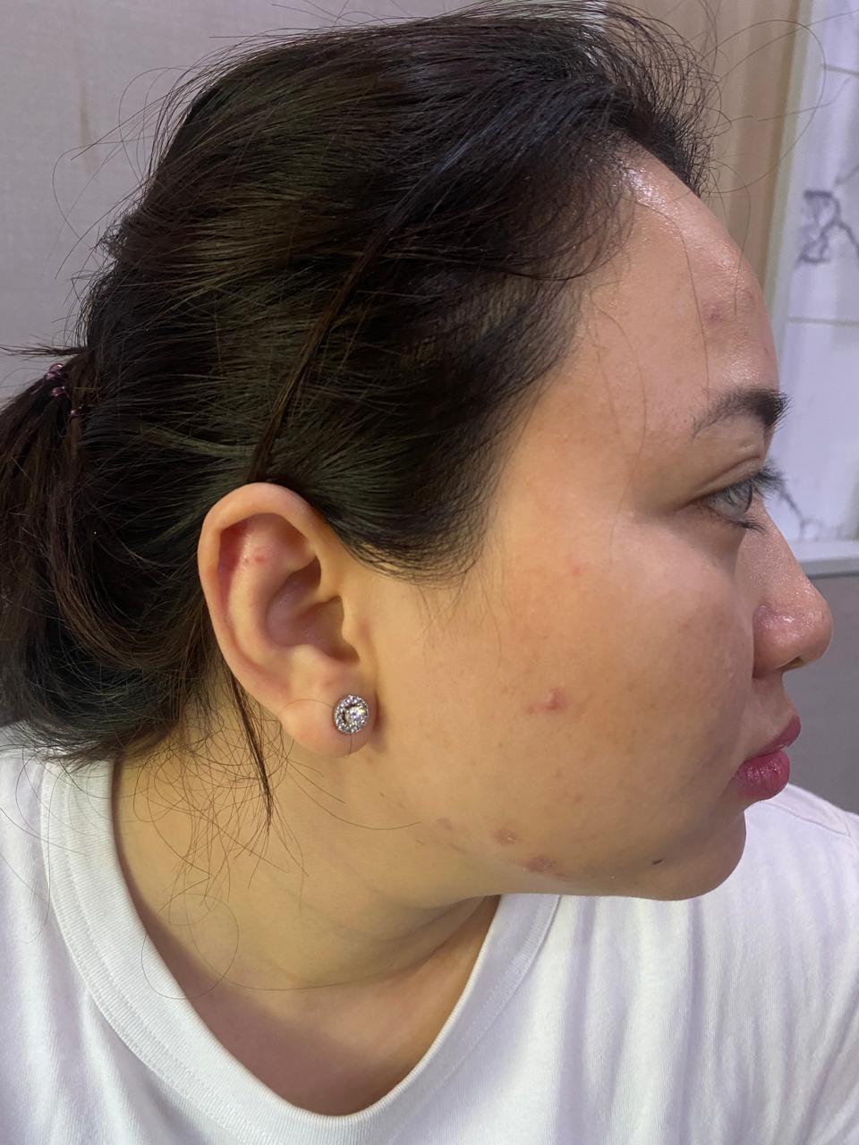 Dokter Kecantikan Laporkan Abang Kandung Kasus Penganiayaan