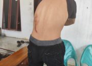 PNS Ngaku Dikeroyok di Pematangsiantar, Oknum Pejabat Pajak-Dokter Disebut Ikut Terlibat