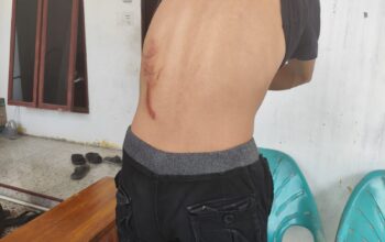 PNS Ngaku Dikeroyok di Pematangsiantar, Oknum Pejabat Pajak-Dokter Disebut Ikut Terlibat