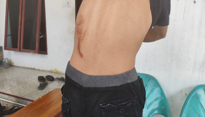 PNS Ngaku Dikeroyok di Pematangsiantar, Oknum Pejabat Pajak-Dokter Disebut Ikut Terlibat