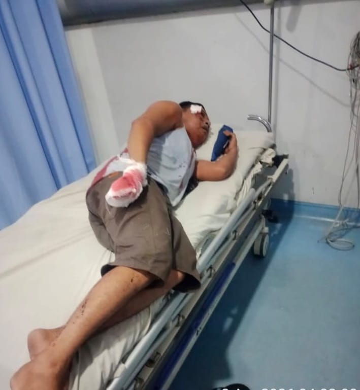 Bandit Jalanan Dan Narkoba Kian Marak, Praktisi Hukum Minta Kapoldasu Evaluasi Kinerja Kapolres Pelabuhan Belawan