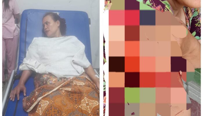 Dua Begal Beraksi Siang Bolong Di Medan Marelan, IRT Luka Sabetan Senjata Tajam