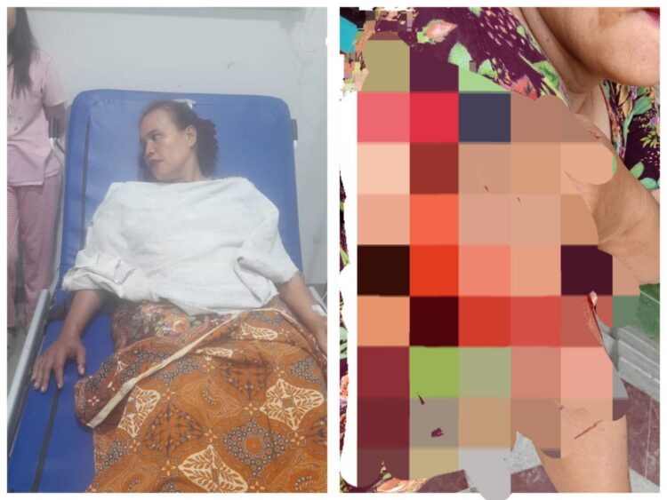 Dua Begal Beraksi Siang Bolong Di Medan Marelan, IRT Luka Sabetan Senjata Tajam